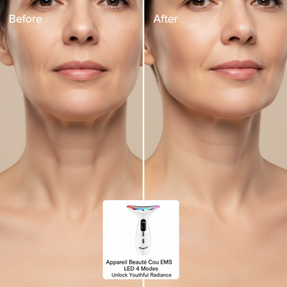 CkeyiN 4 Color Neck Beauty Device EMS Face Lifting Machine Double Chin Remover LED Anti Wrinkle Skin Tightening Facial Massager